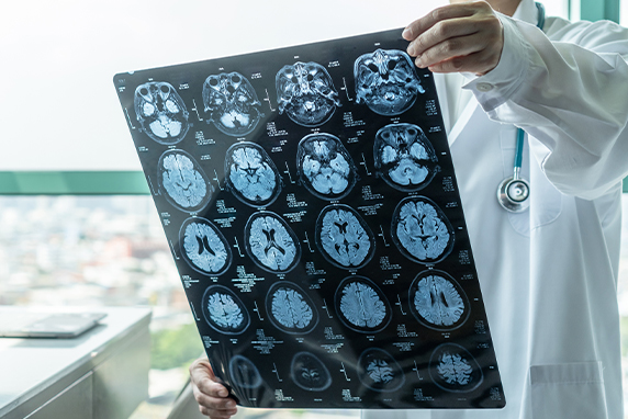 Lexington traumatic brain injury lawyers