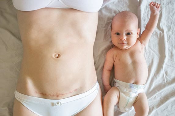 Kentucky Delayed or Negligent C-Section Lawyers Kentucky Delayed or Negligent C-Section Lawyers