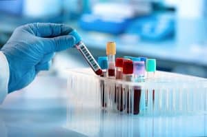 Common Medical Laboratory Errors to Look Out For